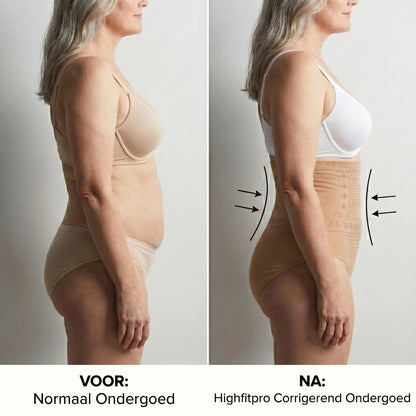HighFitPro™ | Ondersteunende afslank onderbroeken | 5+5 GRATIS